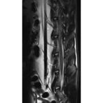 T2 sequence of a rabbit spine(3 Tesla)
